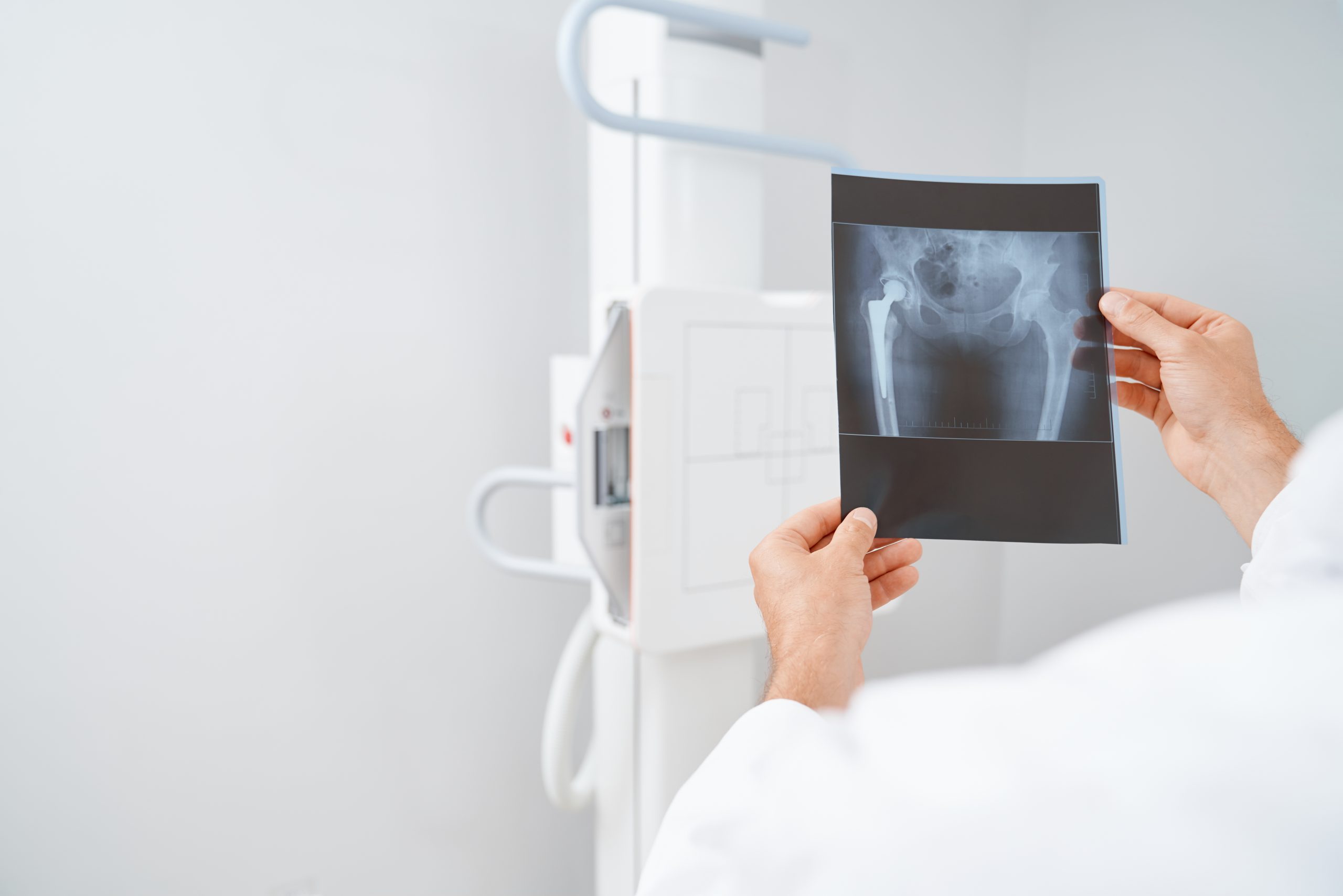 Afecțiuni neurologice tratate la Arra Medical Center Iași – migrene, epilepsie, AVC, scleroză